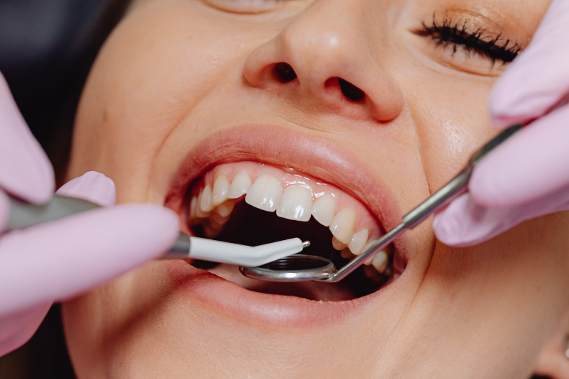 Genetics and Tooth Decay