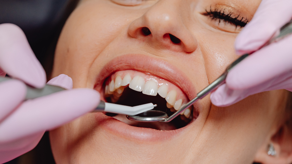 Genetics and Tooth Decay